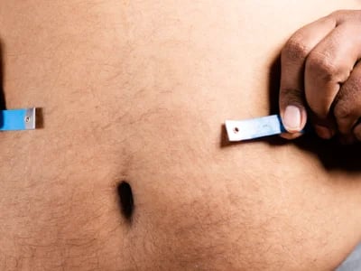 Magenverkleinerung Türkei Kosten: Warum Patienten sich für die Türkei entscheiden