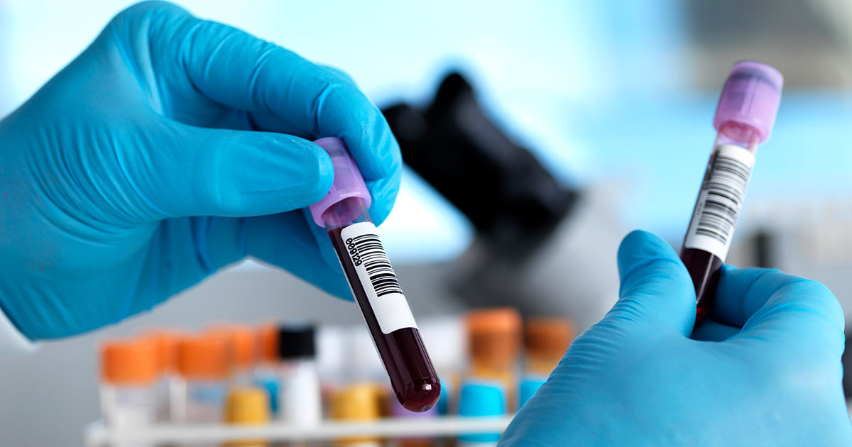 Patientensicherheit erhöhen durch korrekte Präanalytik